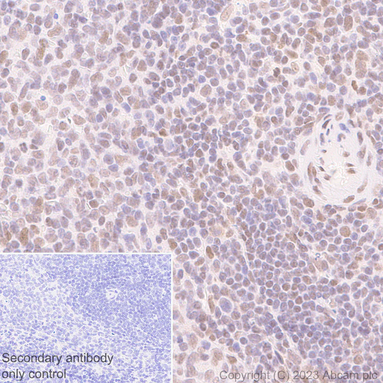 Immunohistochemistry (Formalin/PFA-fixed paraffin-embedded sections) - Anti-SA2 (isoform-2) antibody [EPR26892-61] - BSA and Azide free (AB313878)