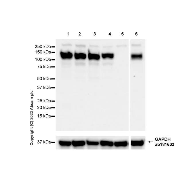Western blot - Anti-SA2 (isoform-2) antibody [EPR26892-61] - BSA and Azide free (AB313878)