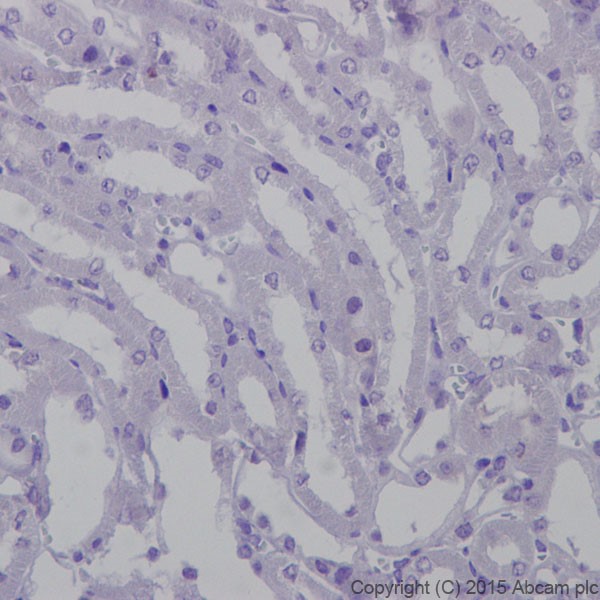 Immunohistochemistry (Formalin/PFA-fixed paraffin-embedded sections) - Anti-SAA1 + SAA2 antibody [EPR19235] (AB199030), expandable thumbnail