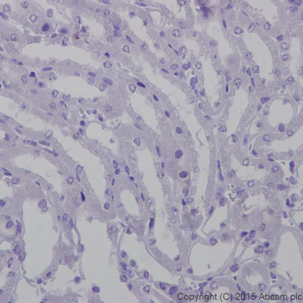Immunohistochemistry (Formalin/PFA-fixed paraffin-embedded sections) - Anti-SAA1 + SAA2 antibody [EPR19235] (AB199030)
