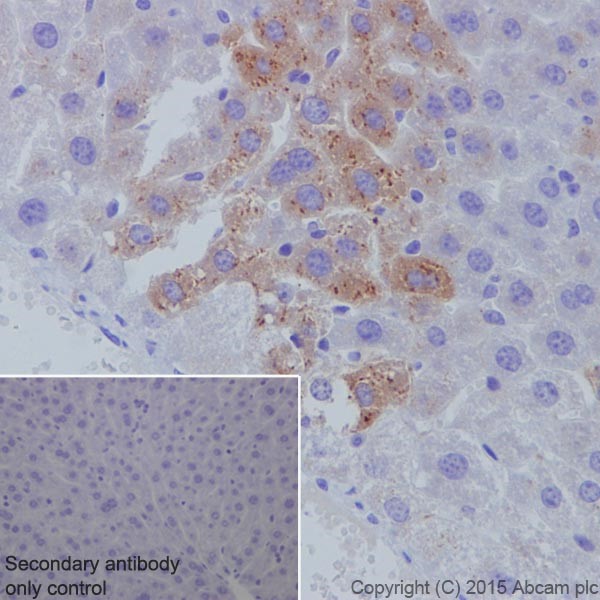 Immunohistochemistry (Formalin/PFA-fixed paraffin-embedded sections) - Anti-SAA1 + SAA2 antibody [EPR19235] (AB199030), expandable thumbnail