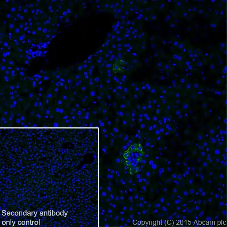 Immunohistochemistry (Frozen sections) - Anti-SAA1 + SAA2 antibody [EPR19235] (AB199030)