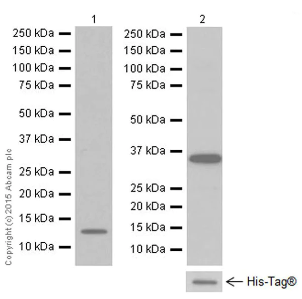Western blot - Anti-SAA1 + SAA2 antibody [EPR19235] (AB199030)