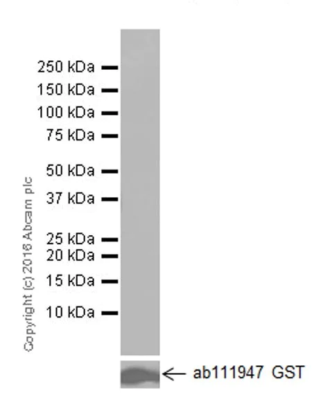 Western blot - Anti-SAA1 + SAA2 antibody [EPR19235] (AB199030)