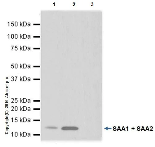 Immunoprecipitation - Anti-SAA1 + SAA2 antibody [EPR19235] - BSA and Azide free (AB251264)