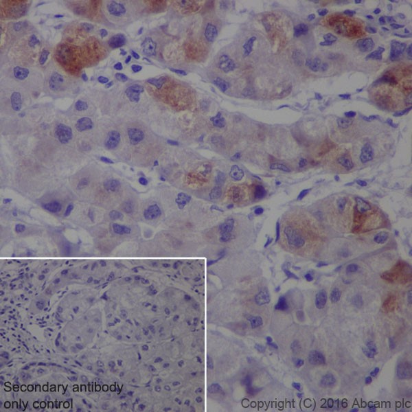 Immunohistochemistry (Formalin/PFA-fixed paraffin-embedded sections) - Anti-SAA1 + SAA2 antibody [EPR19550] (AB207445)