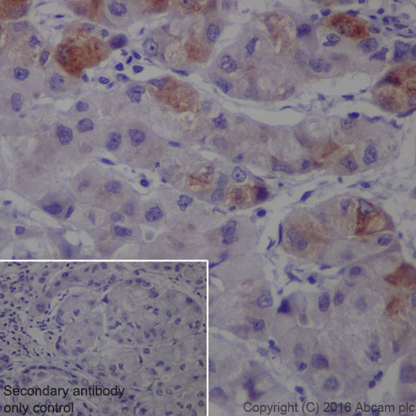 Immunohistochemistry (Formalin/PFA-fixed paraffin-embedded sections) - Anti-SAA1 + SAA2 antibody [EPR19550] - BSA and Azide free (AB251476)