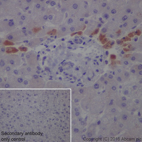 Immunohistochemistry (Formalin/PFA-fixed paraffin-embedded sections) - Anti-SAA1 + SAA2 antibody [EPR19550] - BSA and Azide free (AB251476), expandable thumbnail