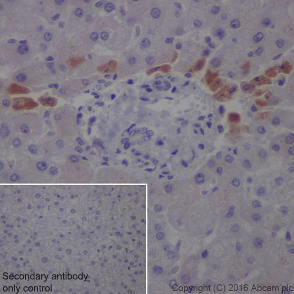 Immunohistochemistry (Formalin/PFA-fixed paraffin-embedded sections) - Anti-SAA1 + SAA2 antibody [EPR19550] - BSA and Azide free (AB251476)