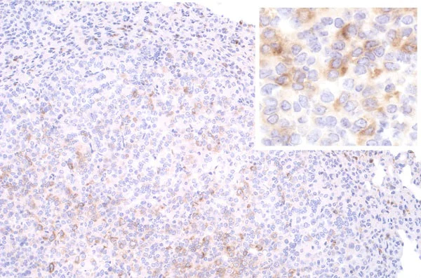 Immunohistochemistry (Formalin/PFA-fixed paraffin-embedded sections) - Anti-SAA3 antibody [JOR110A] (AB231680)