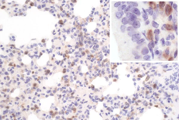 Immunohistochemistry (Formalin/PFA-fixed paraffin-embedded sections) - Anti-SAA3 antibody [JOR110A] (AB231680)