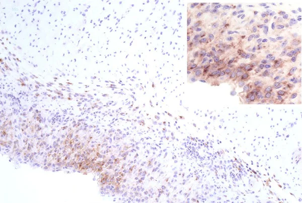 Immunohistochemistry (Formalin/PFA-fixed paraffin-embedded sections) - Anti-SAA3 antibody [JOR110A] (AB231680)