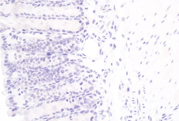 Immunohistochemistry (Formalin/PFA-fixed paraffin-embedded sections) - Anti-SAA3 antibody [JOR110A] (AB231680)