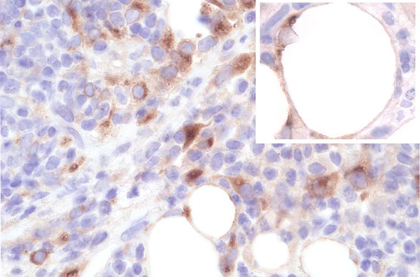 Immunohistochemistry (Formalin/PFA-fixed paraffin-embedded sections) - Anti-SAA3 antibody [JOR110A] (AB231680)