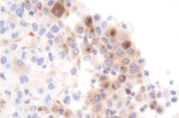 Immunohistochemistry (Formalin/PFA-fixed paraffin-embedded sections) - Anti-SAA3 antibody [JOR110A] (AB231680)