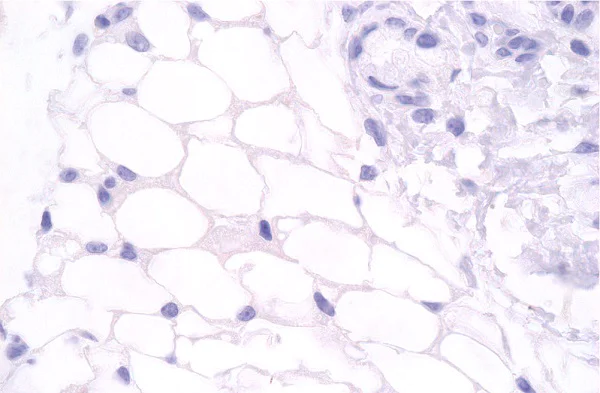 Immunohistochemistry (Formalin/PFA-fixed paraffin-embedded sections) - Anti-SAA3 antibody [JOR110A] (AB231680)