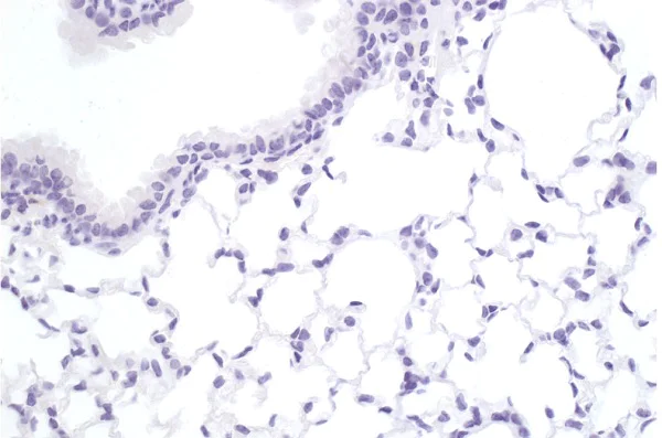 Immunohistochemistry (Formalin/PFA-fixed paraffin-embedded sections) - Anti-SAA3 antibody [JOR110A] (AB231680)