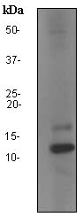 Western blot - Anti-SAA4 antibody [EPR2926] (AB92540), expandable thumbnail