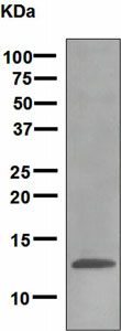 Western blot - Anti-SAA4 antibody [EPR2927] (AB133312)