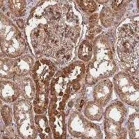 Immunohistochemistry (Formalin/PFA-fixed paraffin-embedded sections) - Anti-SAC3D1 antibody (AB122809)