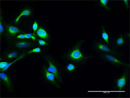 Immunocytochemistry/ Immunofluorescence - Anti-SACM1L/Sac1 antibody (AB172402)