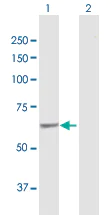 Western blot - Anti-SACM1L/Sac1 antibody (AB172402)