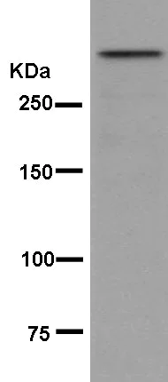 Western blot - Anti-Sacsin antibody [EPR11864-61] - BSA and Azide free (AB250426)