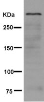 Western blot - Anti-Sacsin antibody [EPR11864] (AB181190)