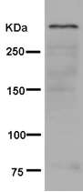 Western blot - Anti-Sacsin antibody [EPR11864] (AB181190)
