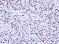 Immunohistochemistry (Formalin/PFA-fixed paraffin-embedded sections) - Anti-SAE1 antibody (AB97523)