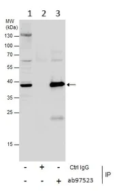 Immunoprecipitation - Anti-SAE1 antibody (AB97523)