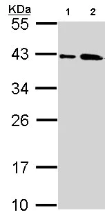 Western blot - Anti-SAE1 antibody (AB97523)