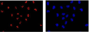 Immunocytochemistry/ Immunofluorescence - Anti-SAE1 antibody [EPR15397(B)] (AB185949)