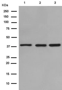 Western blot - Anti-SAE1 antibody [EPR15397(B)] (AB185949)