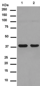 Western blot - Anti-SAE1 antibody [EPR15397(B)] (AB185949)