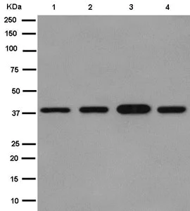 Western blot - Anti-SAE1 antibody [EPR15398] (AB185552)
