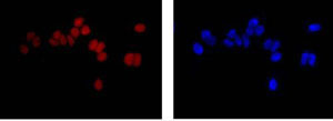 Immunocytochemistry/ Immunofluorescence - Anti-SAE1 antibody [EPR15398] - BSA and Azide free (AB232630)