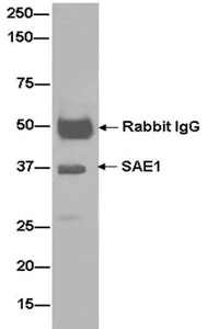 Immunoprecipitation - Anti-SAE1 antibody [EPR15398] - BSA and Azide free (AB232630)