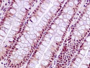 Immunohistochemistry (Formalin/PFA-fixed paraffin-embedded sections) - Anti-SAE2 / UBA2 antibody [EPR14880] (AB185955)