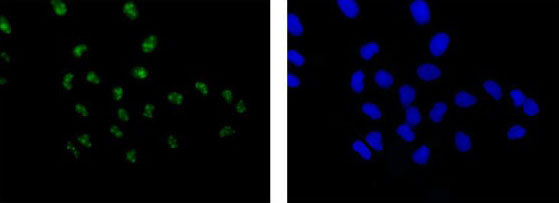 Immunocytochemistry/ Immunofluorescence - Anti-SAE2 / UBA2 antibody [EPR14880] - BSA and Azide free (ab250858), expandable thumbnail