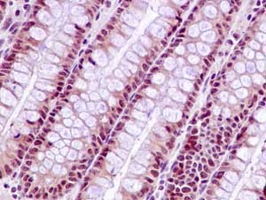 Immunohistochemistry (Formalin/PFA-fixed paraffin-embedded sections) - Anti-SAE2 / UBA2 antibody [EPR14880] - BSA and Azide free (AB250858), expandable thumbnail