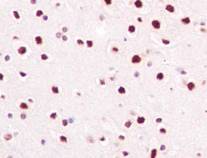 Immunohistochemistry (Formalin/PFA-fixed paraffin-embedded sections) - Anti-SAE2 / UBA2 antibody [EPR14880] - BSA and Azide free (AB250858), expandable thumbnail