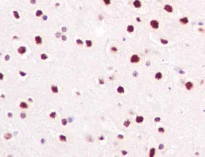 Immunohistochemistry (Formalin/PFA-fixed paraffin-embedded sections) - Anti-SAE2 / UBA2 antibody [EPR14880] - BSA and Azide free (AB250858)
