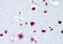 Immunohistochemistry (Formalin/PFA-fixed paraffin-embedded sections) - Anti-SAF-B2 antibody [6F7] (AB67344)