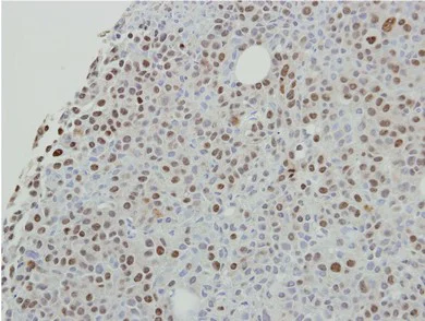Immunohistochemistry (Formalin/PFA-fixed paraffin-embedded sections) - Anti-SAF-B2 antibody (AB104220)