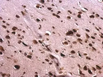 Immunohistochemistry (Formalin/PFA-fixed paraffin-embedded sections) - Anti-SAFB antibody (AB97520)