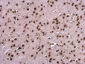 Immunohistochemistry (Formalin/PFA-fixed paraffin-embedded sections) - Anti-SAFB antibody (AB97520)