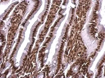 Immunohistochemistry (Formalin/PFA-fixed paraffin-embedded sections) - Anti-SAFB antibody (AB97520)