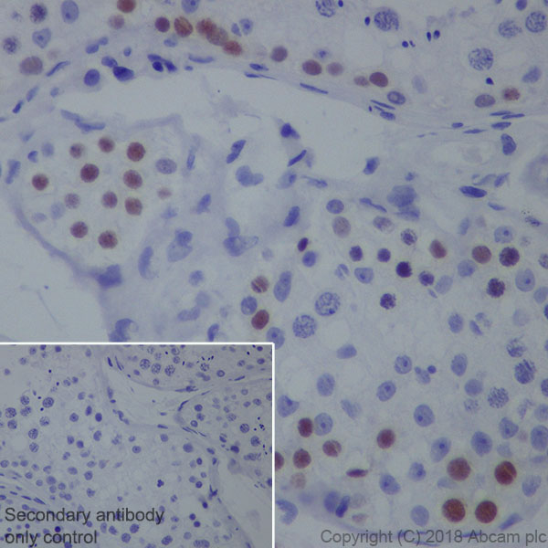 Immunohistochemistry (Formalin/PFA-fixed paraffin-embedded sections) - Anti-SAGE1 antibody [EPR21747] (AB233388), expandable thumbnail