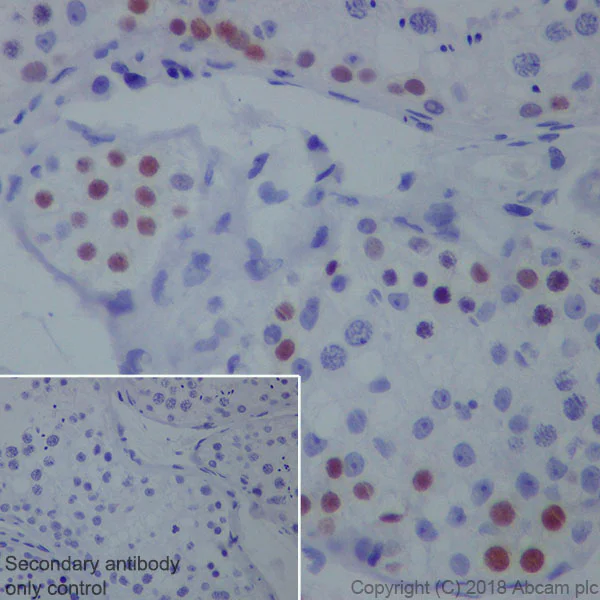 Immunohistochemistry (Formalin/PFA-fixed paraffin-embedded sections) - Anti-SAGE1 antibody [EPR21747] (AB233388)